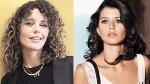 Burun Estetiği Olan Kadın Ünlüler