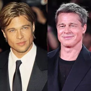 Burun Estetiği Olan Erkek Ünlüler