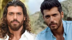 Burun Estetiği Olan Erkek Ünlüler