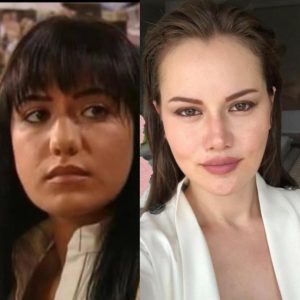 Burun Estetiği Olan Kadın Ünlüler