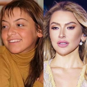 Burun Estetiği Olan Kadın Ünlüler