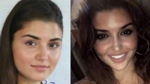 Burun Estetiği Olan Kadın Ünlüler