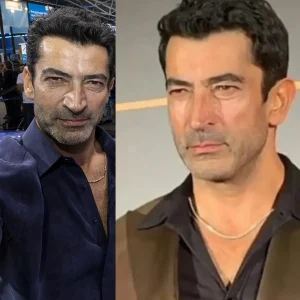 Burun Estetiği Olan Erkek Ünlüler