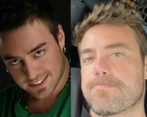 Burun Estetiği Olan Erkek Ünlüler