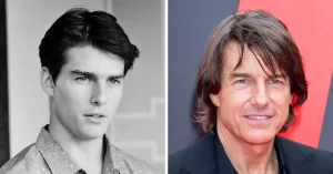 Burun Estetiği Olan Erkek Ünlüler