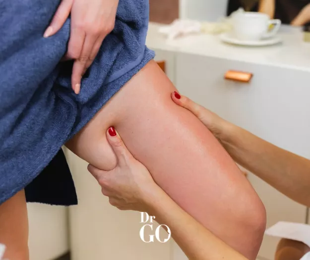 Bacak Estetiği Sonrası Ödem Ne Zaman Geçer?