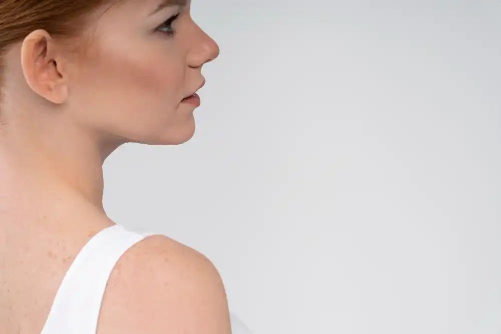 Çene Ucu Estetiği ile Profil Düzeltme