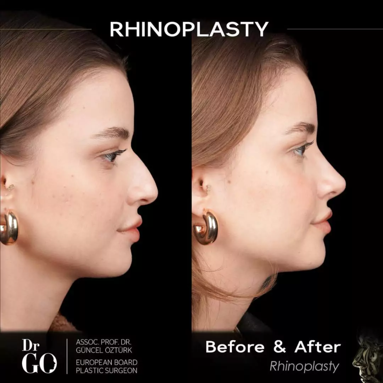 начална страница 104 beforeafter-1.png
