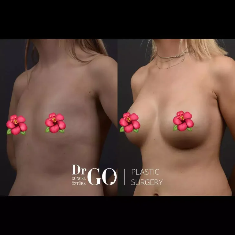 начална страница 115 beforeafter-12-1.webp