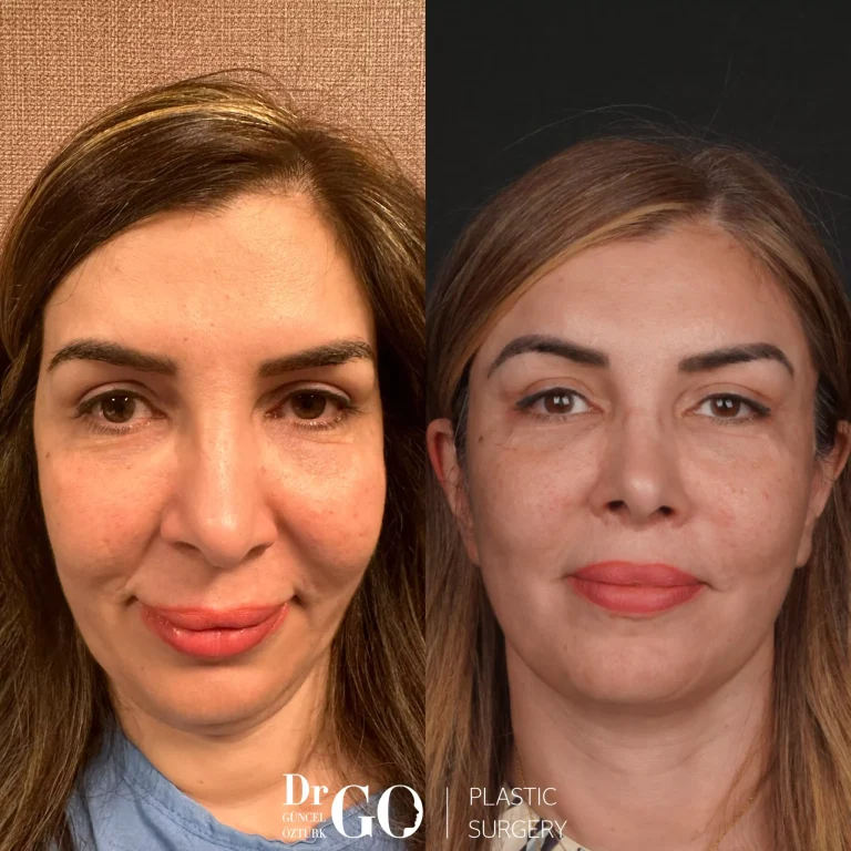 начална страница 124 beforeafter-12-1-scaled-3.webp