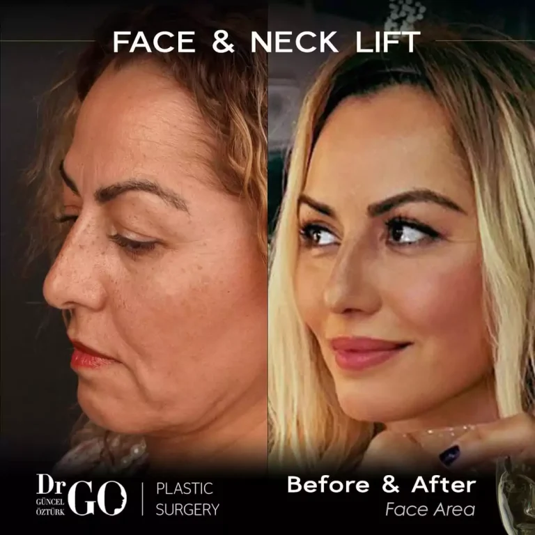 начална страница 123 beforeafter-2-1-2.webp