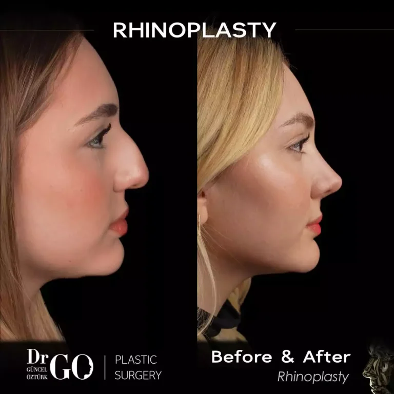 начална страница 105 beforeafter-3.webp