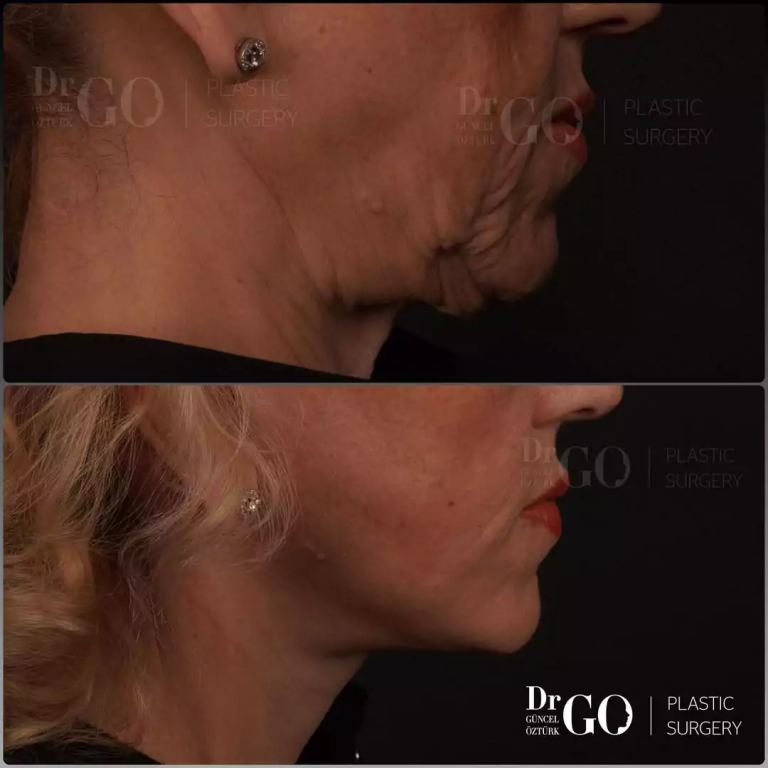 начална страница 125 beforeafter-3-_1_-1.png