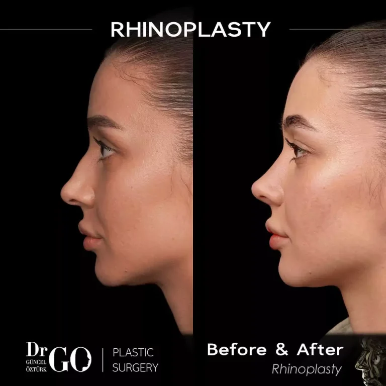 начална страница 98 beforeafter-4.webp