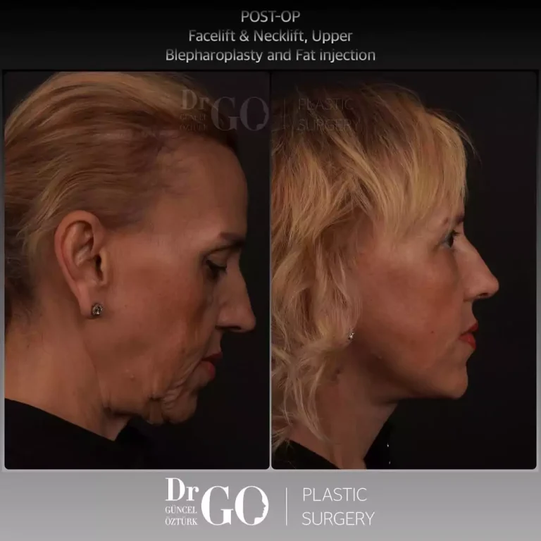 начална страница 128 beforeafter-5-1-1.webp