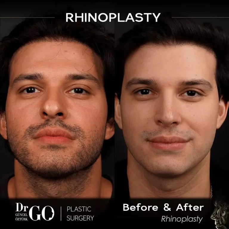 начална страница 103 beforeafter-5.webp