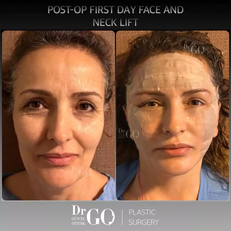 начална страница 127 beforeafter-6-1.png