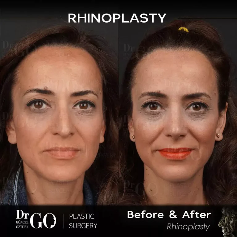 начална страница 101 beforeafter-6.webp