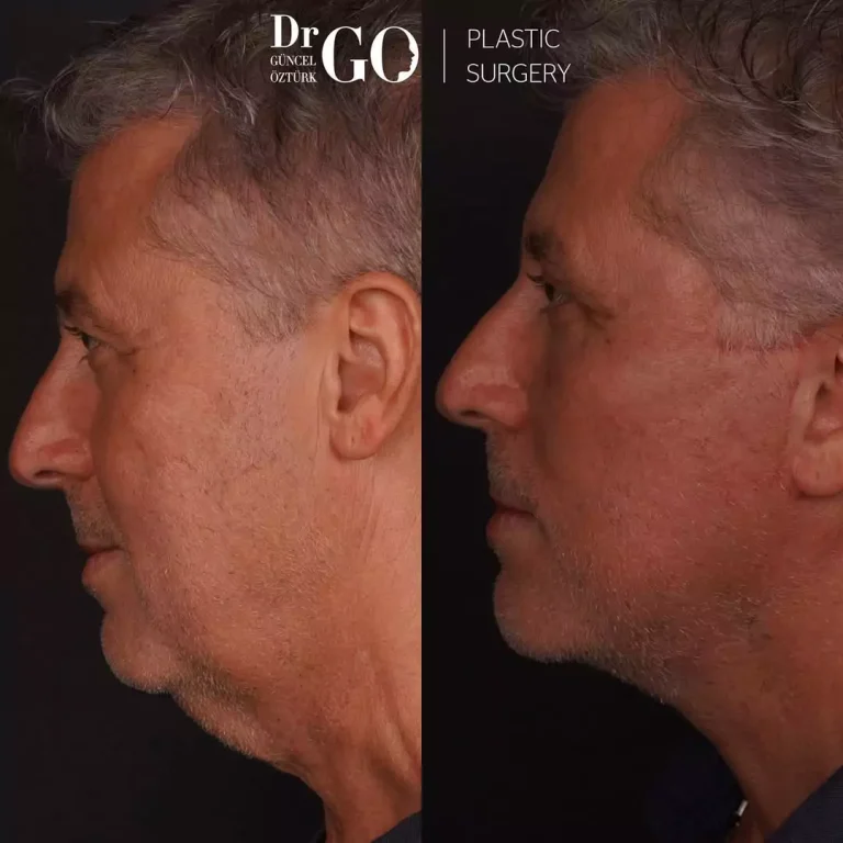 начална страница 126 beforeafter-7.webp