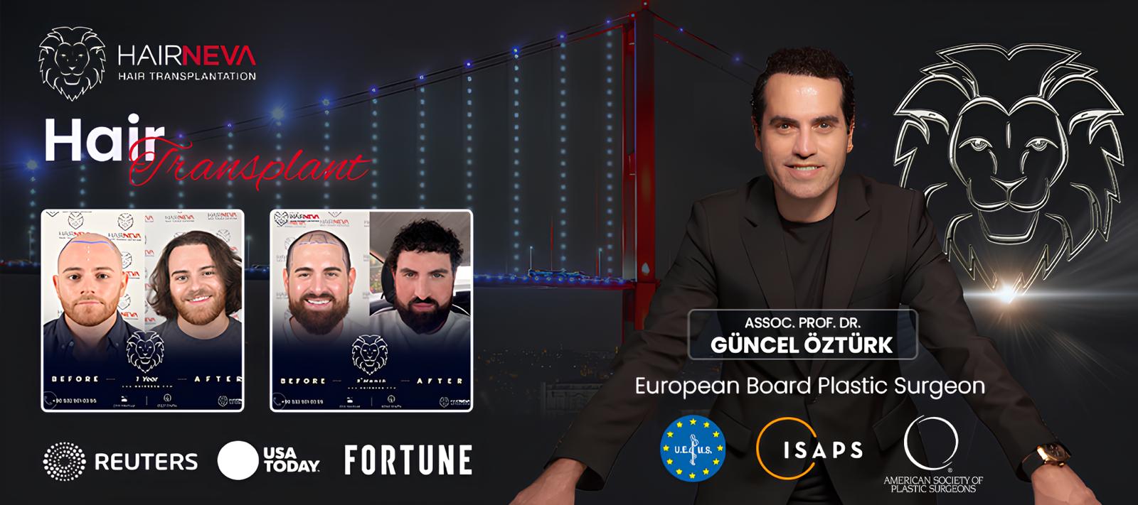 Best Hair Transplant Surgeon Istanbul, Turkey | Assoc. Prof. Dr. Guncel Ozturk, Expert Hair Restoration 1 best-hair-transplant-in-turkey