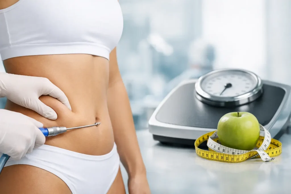 Liposuction Kilo Verme Yöntemi midir?